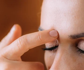 anti_acne_botox_1_ (1)